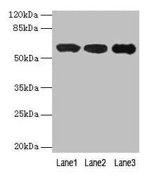 Polyclonal Rabbit anti-Human IMPDH2 Antibody (IHC, WB)