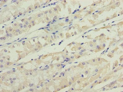 TMEM31 Antibody