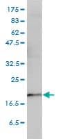 PTGES3 / p23 Antibody (clone 3H1-2A8)