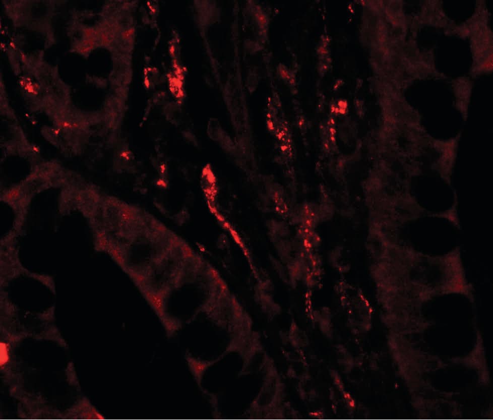 IHC-plus™ Polyclonal Rabbit anti-Human TSC22D3 / GILZ Antibody (IHC, IF, WB)