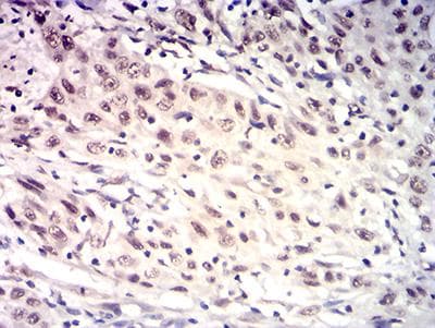 HTRA2 / OMI Antibody (clone 6H7A8)