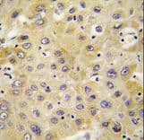 Polyclonal Rabbit anti-Human CXCL7 / PPBP Antibody (aa97-128, IHC, WB)