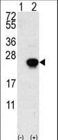 Polyclonal Rabbit anti-Human FGF1 / Acidic FGF Antibody (aa5-30, IHC, IF, WB)