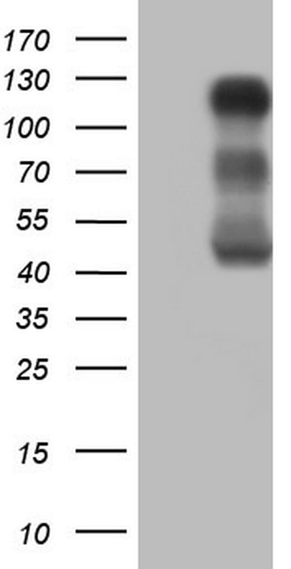 Monoclonal Mouse anti-Human LPIN1 / Lipin 1 Antibody (clone OTI2H6, Carrier-free, aa1-274, IHC, WB)