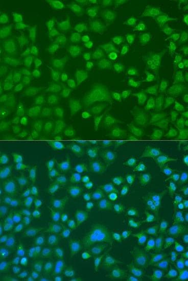 EWSR1 / EWS Antibody