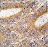 AURKA / Aurora-A Antibody (aa90-120)