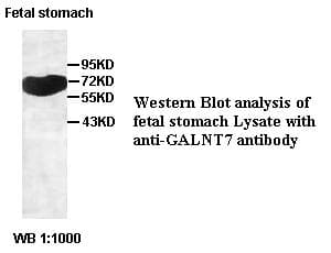 IHC-plus™ Polyclonal Rabbit anti-Human GALNT7 Antibody (IHC, WB)