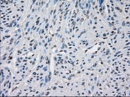 BUB1B / BubR1 Antibody (clone OTI10E7)