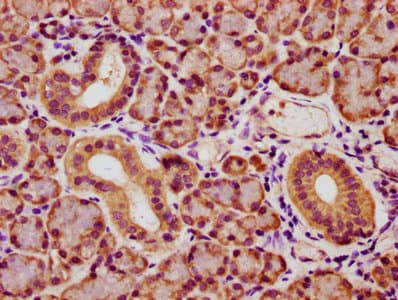 YWHAQ / 14-3-3 Theta Antibody (aa1-245)
