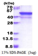 Human MMP28 Protein (Recombinant His)