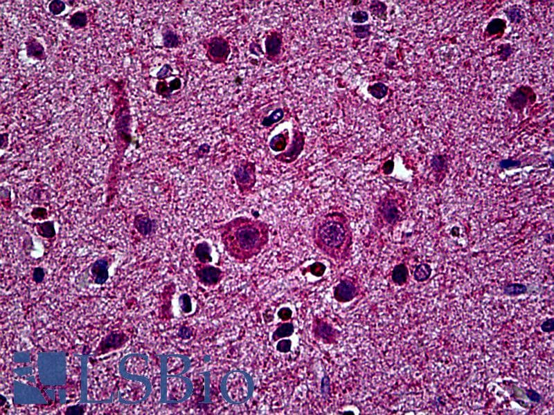 IHC-plus™ SOLO / SESTD1 Antibody