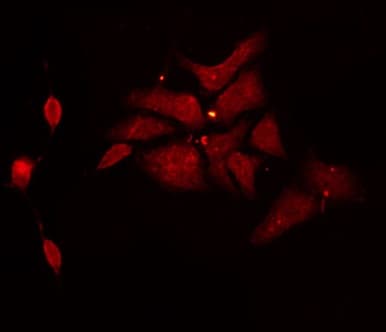 CYB561D1 Antibody