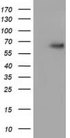 Alpha-Fetoprotein Antibody (clone OTI4D2)