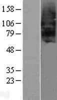 SCTR / SR / Secretin Receptor Protein (Over-Expression Lysate Myc-DDK (Flag))