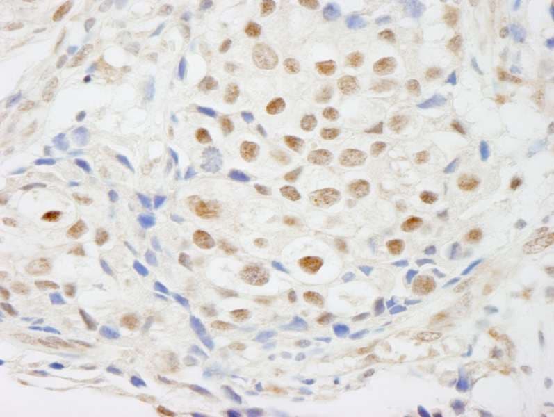 ZNF318 Antibody (aa2049-2099)