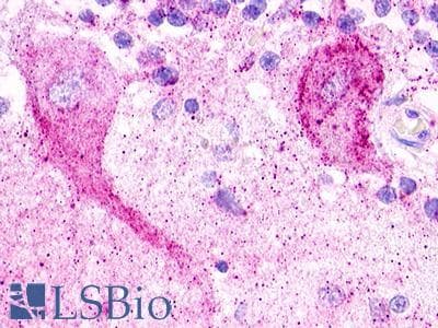 PathPlus™ Polyclonal Rabbit anti-Human MAS1L / MRG Antibody (C-Terminus, IHC)