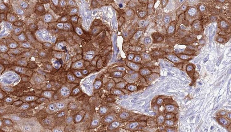 Polyclonal Rabbit anti-Human KLRD1 / CD94 Antibody (IHC, IF, WB)