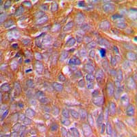 Polyclonal Rabbit anti-Human CASP8 / Caspase 8 Antibody (phospho-Ser347, IHC, WB)