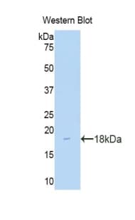 ITGAM / CD11b Antibody (aa31-160)