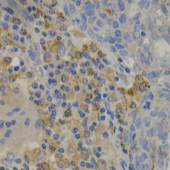 Polyclonal Rabbit anti-Human PAK1 Antibody (IHC, WB)
