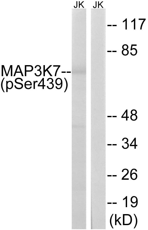 Polyclonal Rabbit anti-Human MAP3K7 / TAK1 Antibody (phospho-Ser439, IHC, WB)