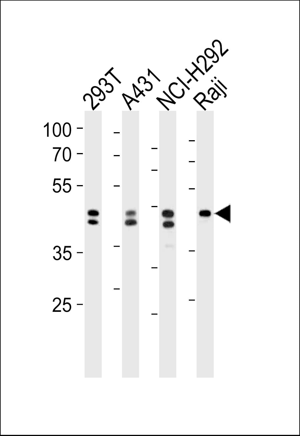 Polyclonal Rabbit anti-Human HNRNPD / AUF1 Antibody (aa57-85, IF, WB)