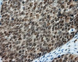TUBA8 / Tubulin Alpha 8 Antibody (clone OTI2E9)