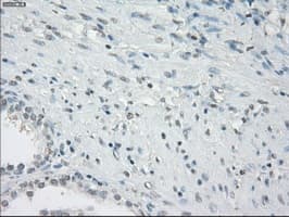 CD32A Antibody (clone OTI9G5)
