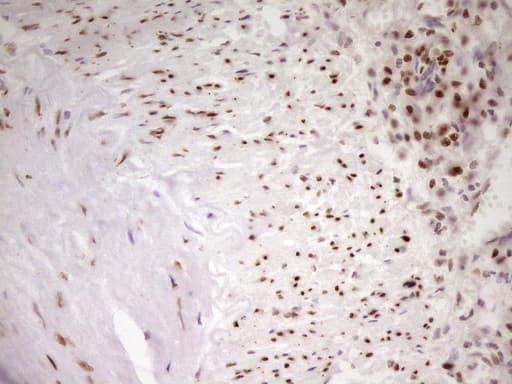 MEF2D Antibody (aa1-282, clone OTI10B4, Carrier-free)