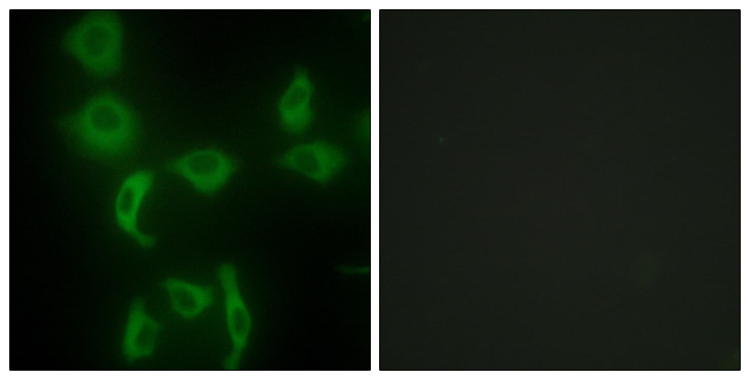 IHC-plus™ IARS2 Antibody (aa71-120)