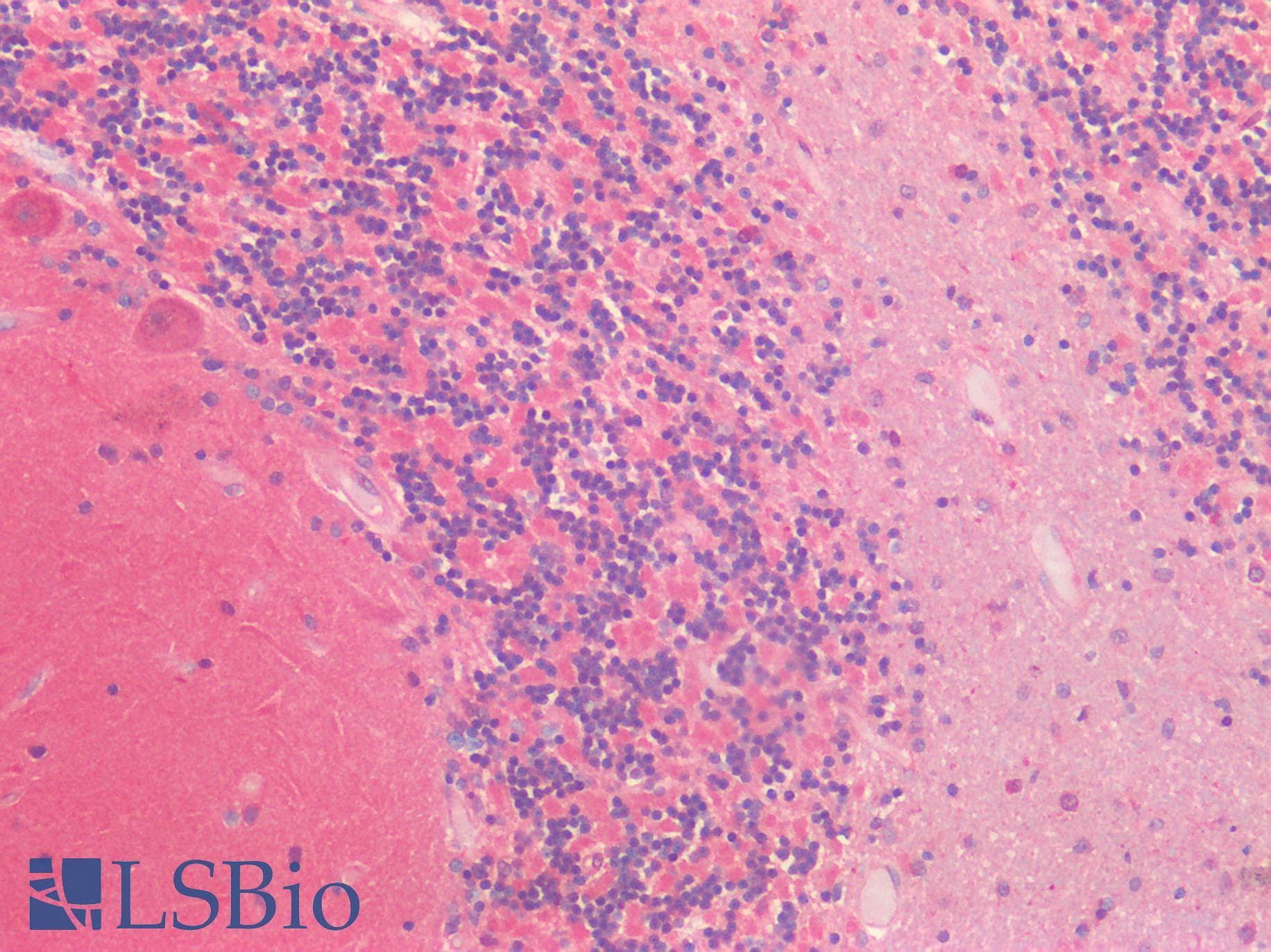 IHC-plus™ TH / Tyrosine Hydroxylase Antibody