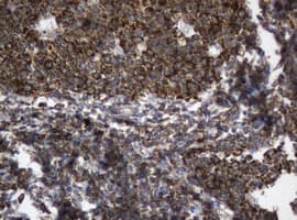 PAI-RBP1 / SERBP1 Antibody (clone OTI2F6)