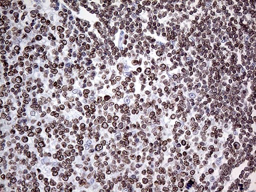 Monoclonal Mouse anti-Human MLH1 Antibody (clone OTI3D1, aa299-527, IHC, WB)