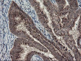 GCP60 / ACBD3 Antibody (clone OTI3A1)