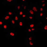 HLX1 / HLX Antibody