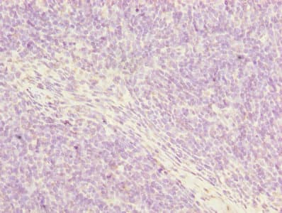 Polyclonal Rabbit anti-Human POSTN / Periostin Antibody (IHC, WB)