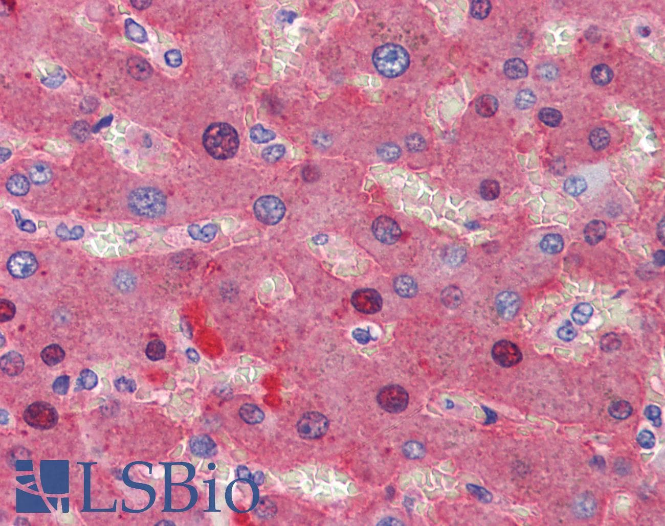IHC-plus™ Monoclonal Mouse anti-Human FGB / Fibrinogen Beta Chain Antibody (clone 1F9, IHC, WB)