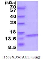 Human ATP6V1F Protein (Recombinant His)