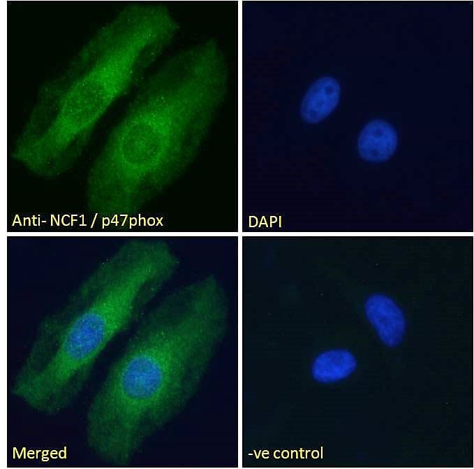 IHC-plus™ Polyclonal Goat anti-Human NCF1 / p47phox / p47 phox Antibody (aa378-390, IHC, IF, WB)