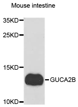 GUCA2B / Uroguanylin Antibody