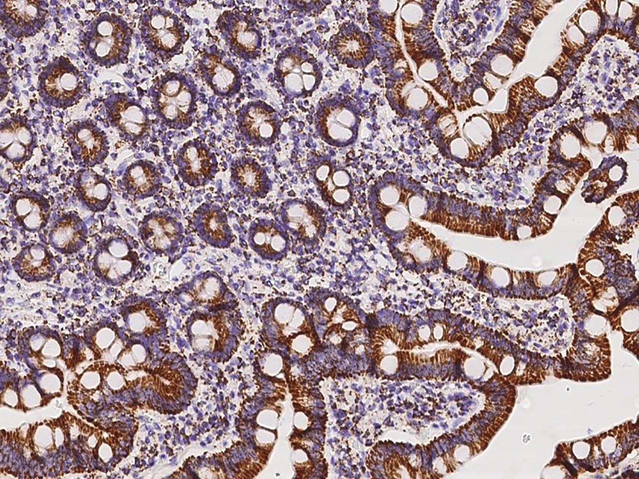 ACADVL Antibody