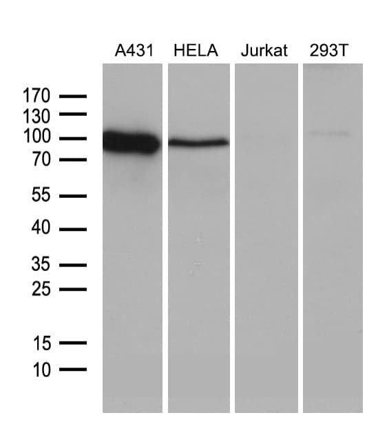 CD30 Antibody (aa408-595, clone OTI2H2)