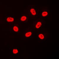 SP3+4 Antibody (C-Terminus)