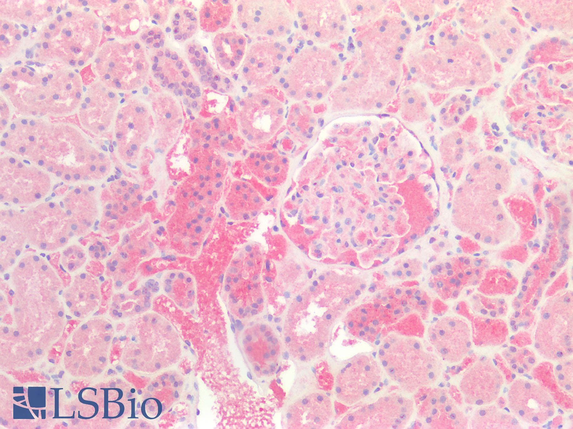 IHC-plus™ PVALB / Parvalbumin Antibody