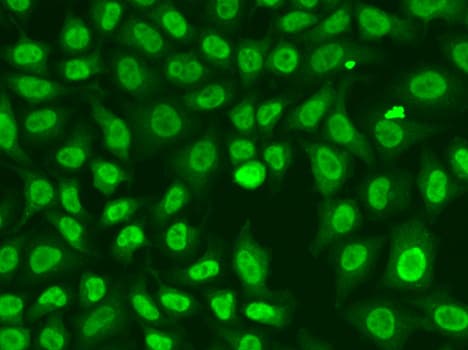 CHEK2 / CHK2 Antibody