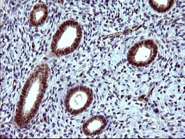 IHC-plus™ TUBB1 / Tubulin Beta 1 Antibody (clone 4A3)