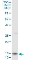 CLPS / Colipase Antibody (clone 8A8)