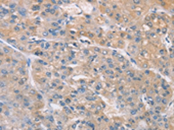 ZADH2 Antibody