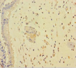 Polyclonal Rabbit anti-Human RARRES3 Antibody
