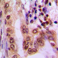PRKAA1 + PRKAA2 Antibody (phospho-Thr183/Thr172)